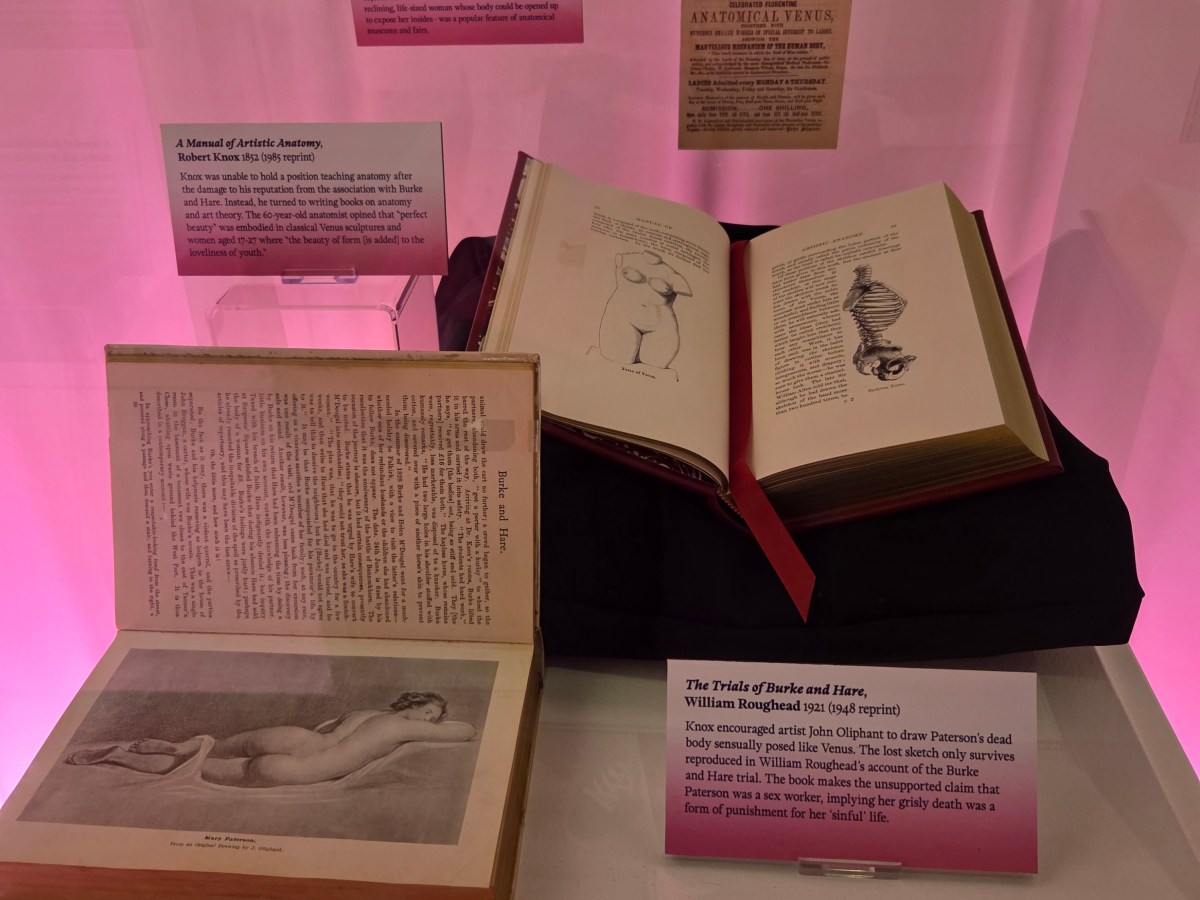 Ethics, Desire, and Sexuality – exploring Anatomy, Art and Power “Beneath the Sheets” at the Thackray,&nbsp;Leeds.